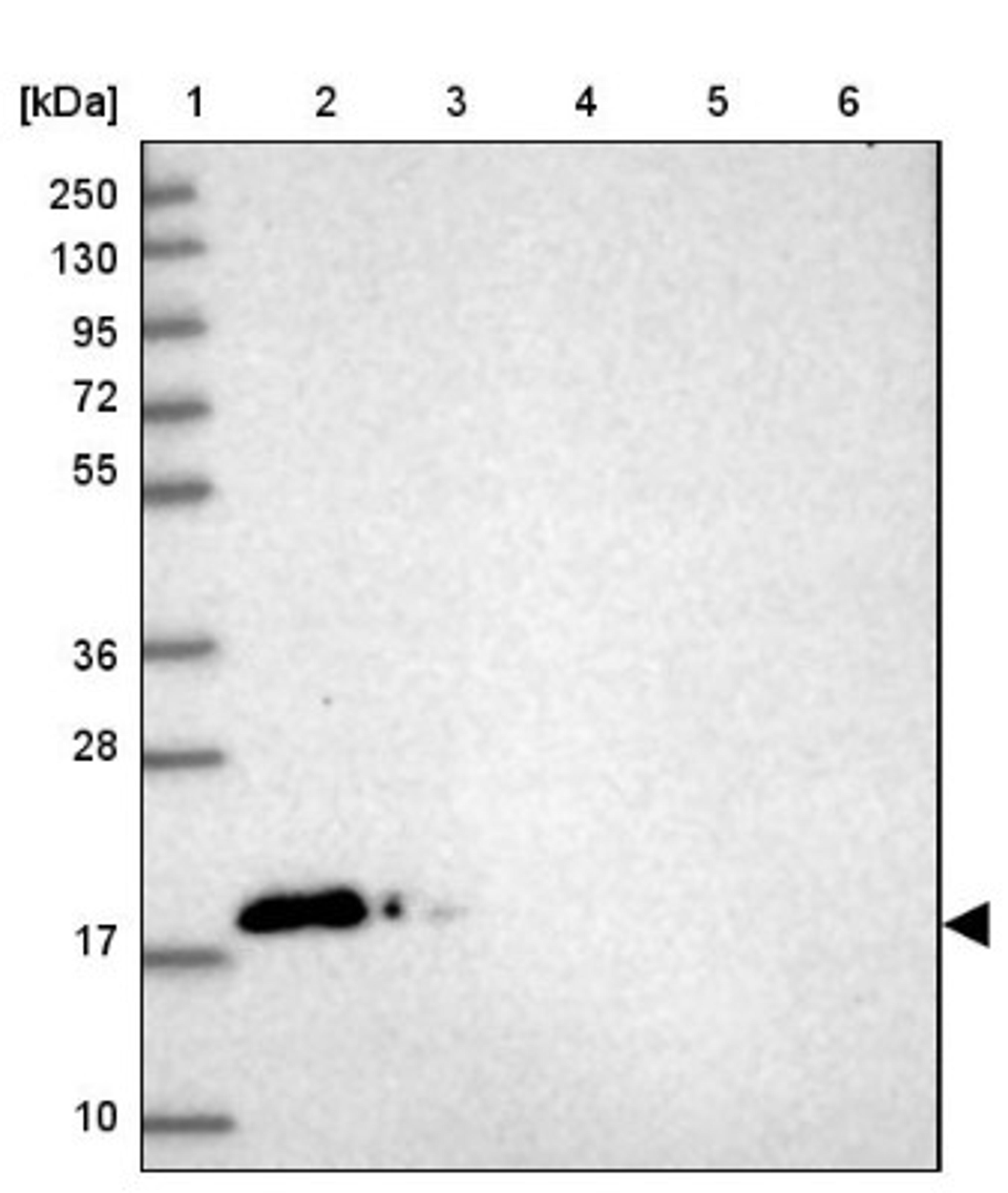 Western Blot: CALML3 Antibody [NBP2-33434] - Lane 1: Marker [kDa] 250, 130, 95, 72, 55, 36, 28, 17, 10<br/>Lane 2: Human cell line RT-4<br/>Lane 3: Human cell line U-251MG sp<br/>Lane 4: Human plasma (IgG/HSA depleted)<br/>Lane 5: Human liver tissue<br/>Lane 6: Human tonsil tissue