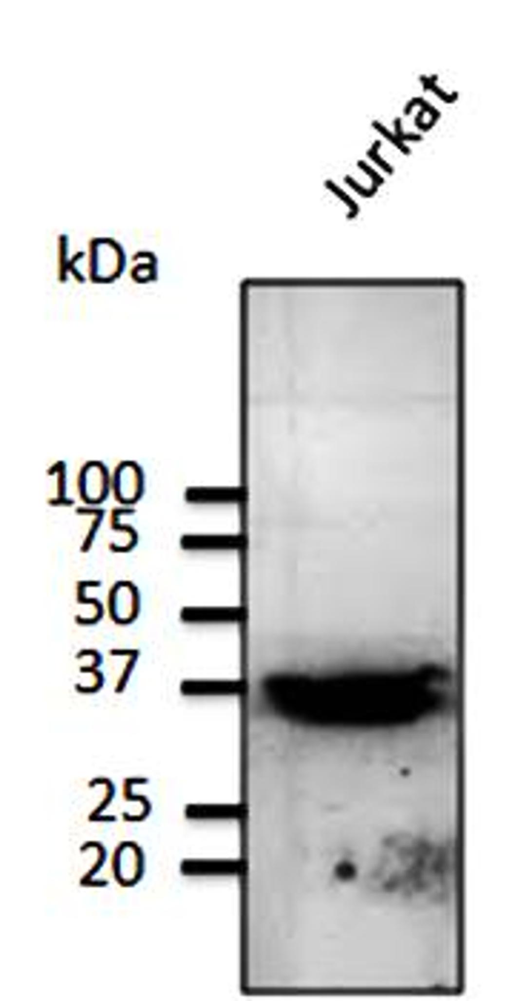 Western blot analysis of Jurkat cell lysate using RP6 antibody