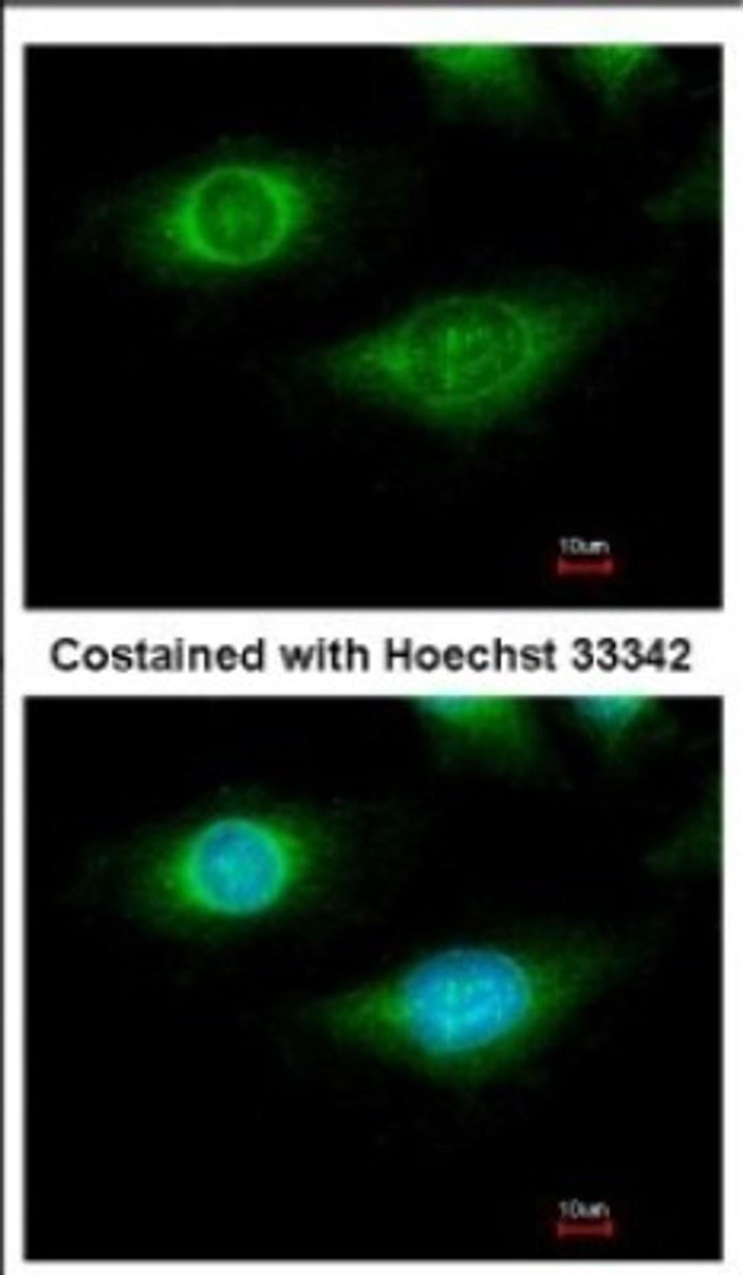 Immunocytochemistry/Immunofluorescence: CYFIP1 Antibody [NBP2-16060] - Immunofluorescence analysis of methanol-fixed HeLa, using antibody at 1:500 dilution.