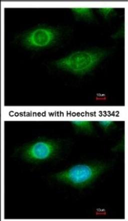 Immunocytochemistry/Immunofluorescence: CYFIP1 Antibody [NBP2-16060] - Immunofluorescence analysis of methanol-fixed HeLa, using antibody at 1:500 dilution.