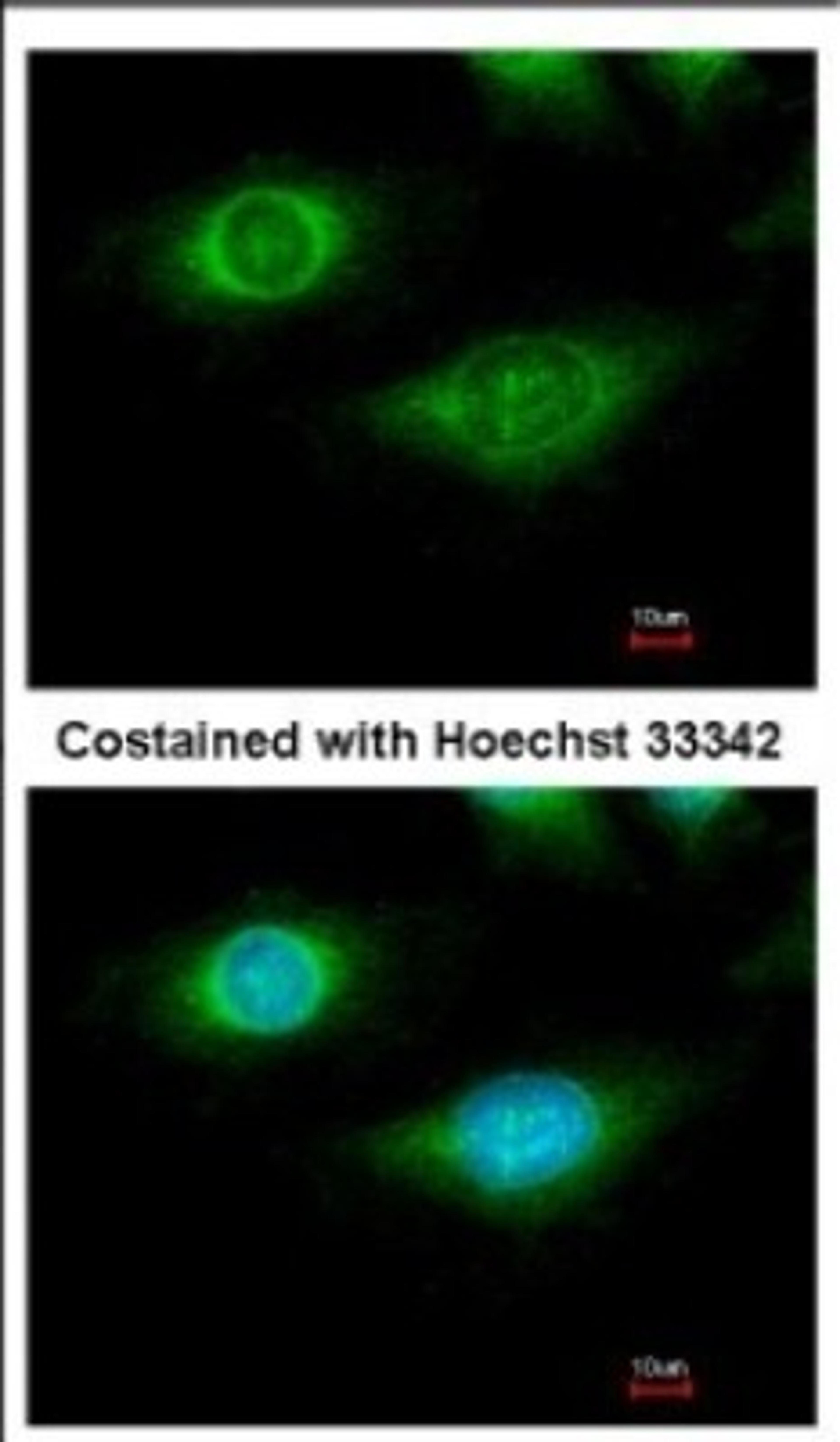 Immunocytochemistry/Immunofluorescence: CYFIP1 Antibody [NBP2-16060] - Immunofluorescence analysis of methanol-fixed HeLa, using antibody at 1:500 dilution.