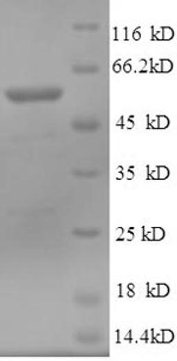 (Tris-Glycine gel) Discontinuous SDS-PAGE (reduced) with 5% enrichment gel and 15% separation gel.