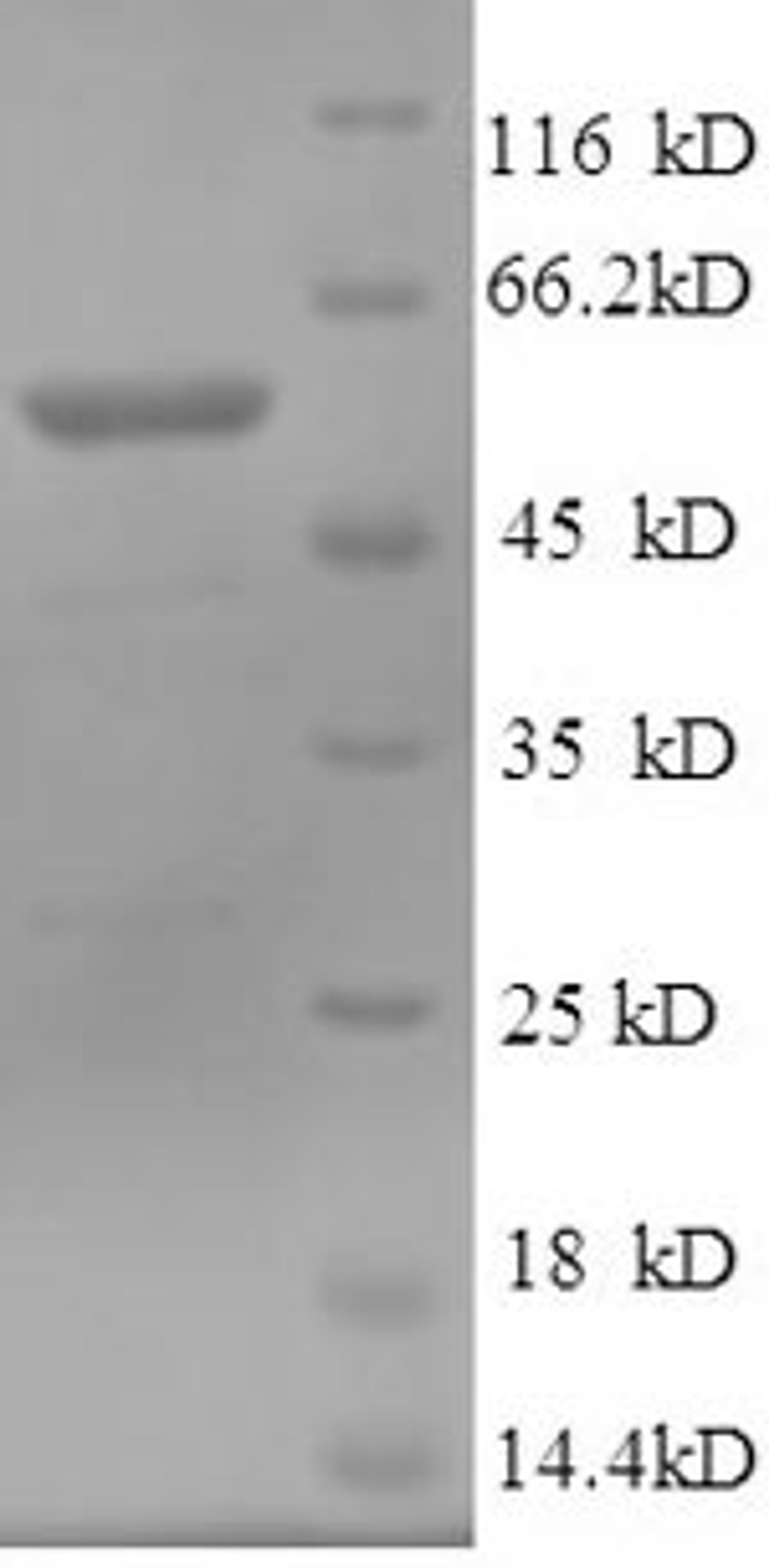 (Tris-Glycine gel) Discontinuous SDS-PAGE (reduced) with 5% enrichment gel and 15% separation gel.