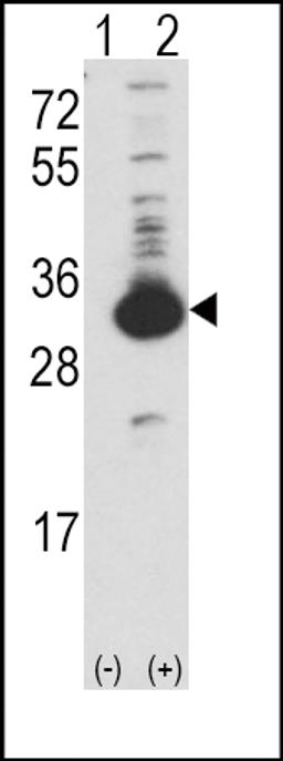 Western blot analysis of KHK using rabbit polyclonal Ketohexokinase (KHK) Antibody using 293 cell lysates (2 ug/lane) either nontransfected (Lane 1) or transiently transfected with the KHK gene (Lane 2).