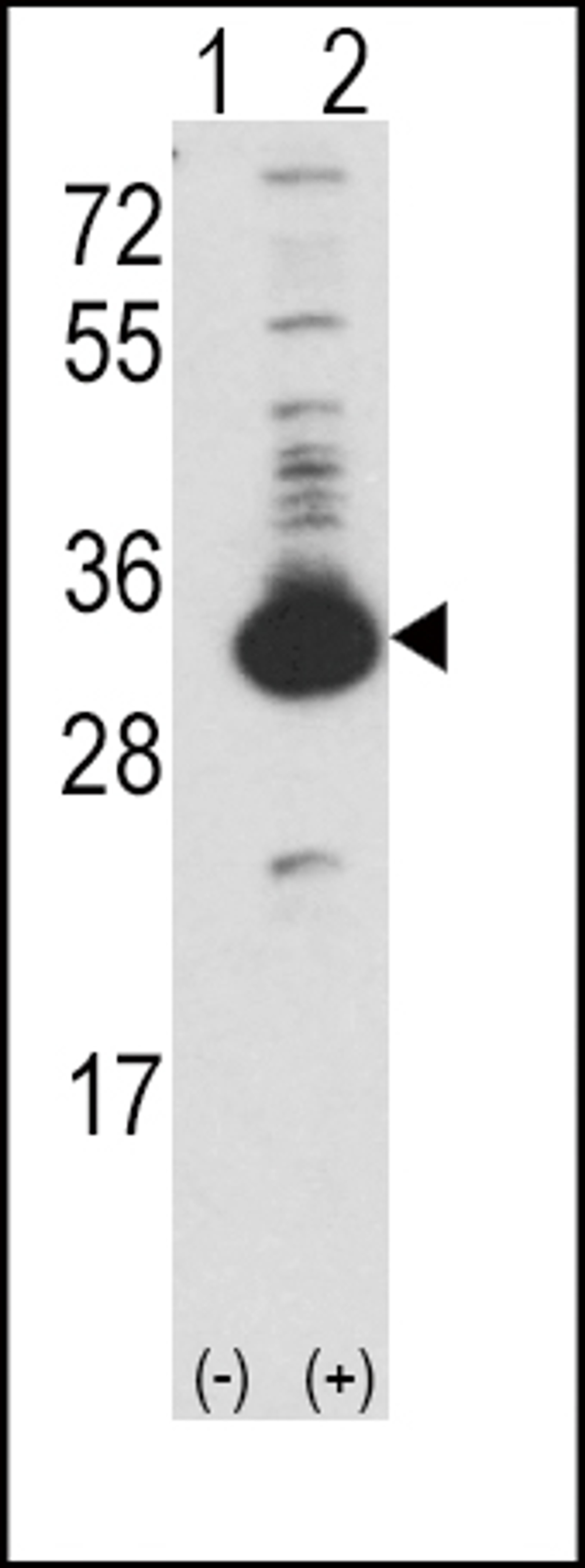 Western blot analysis of KHK using rabbit polyclonal Ketohexokinase (KHK) Antibody using 293 cell lysates (2 ug/lane) either nontransfected (Lane 1) or transiently transfected with the KHK gene (Lane 2).