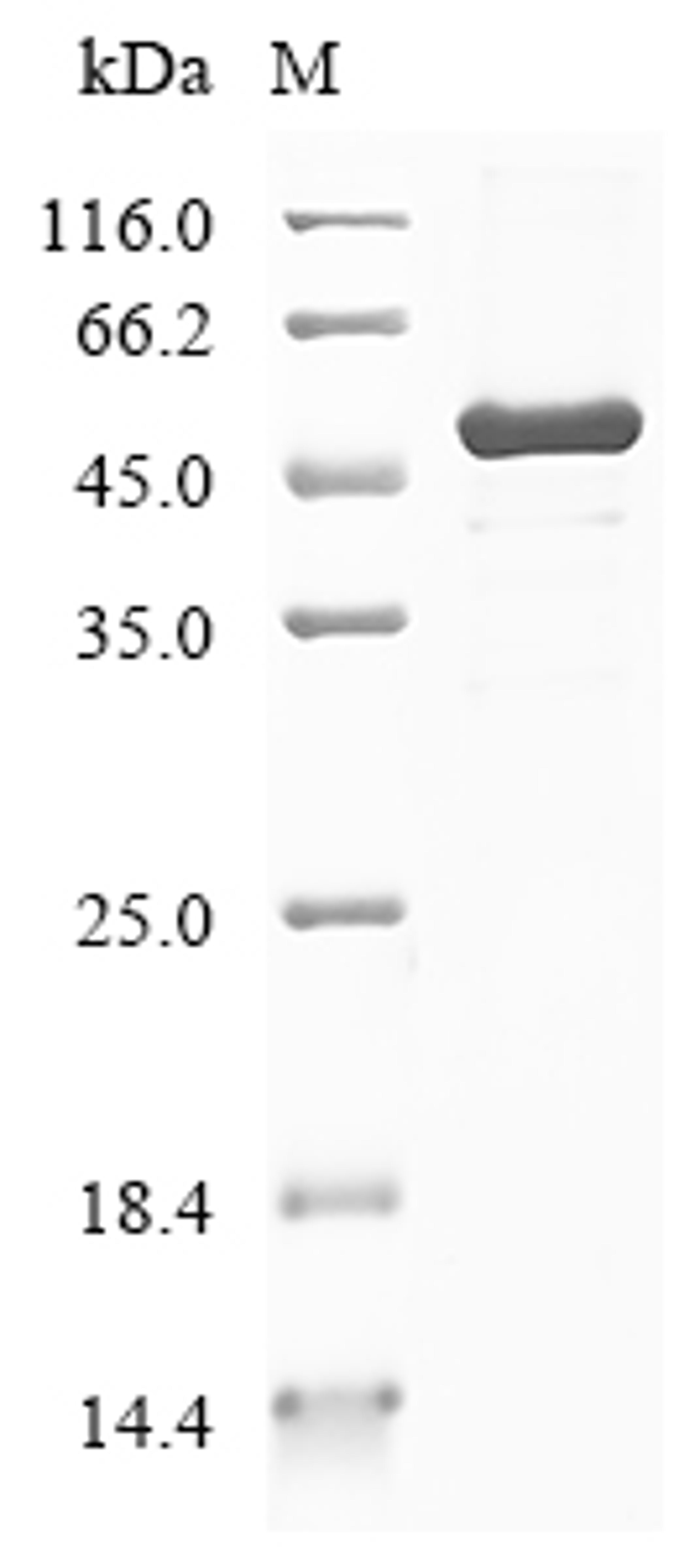 (Tris-Glycine gel) Discontinuous SDS-PAGE (reduced) with 5% enrichment gel and 15% separation gel.