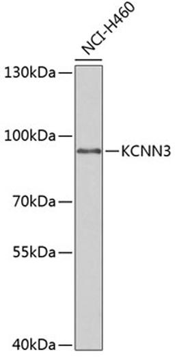 Western blot - KCNN3 antibody (A6125)