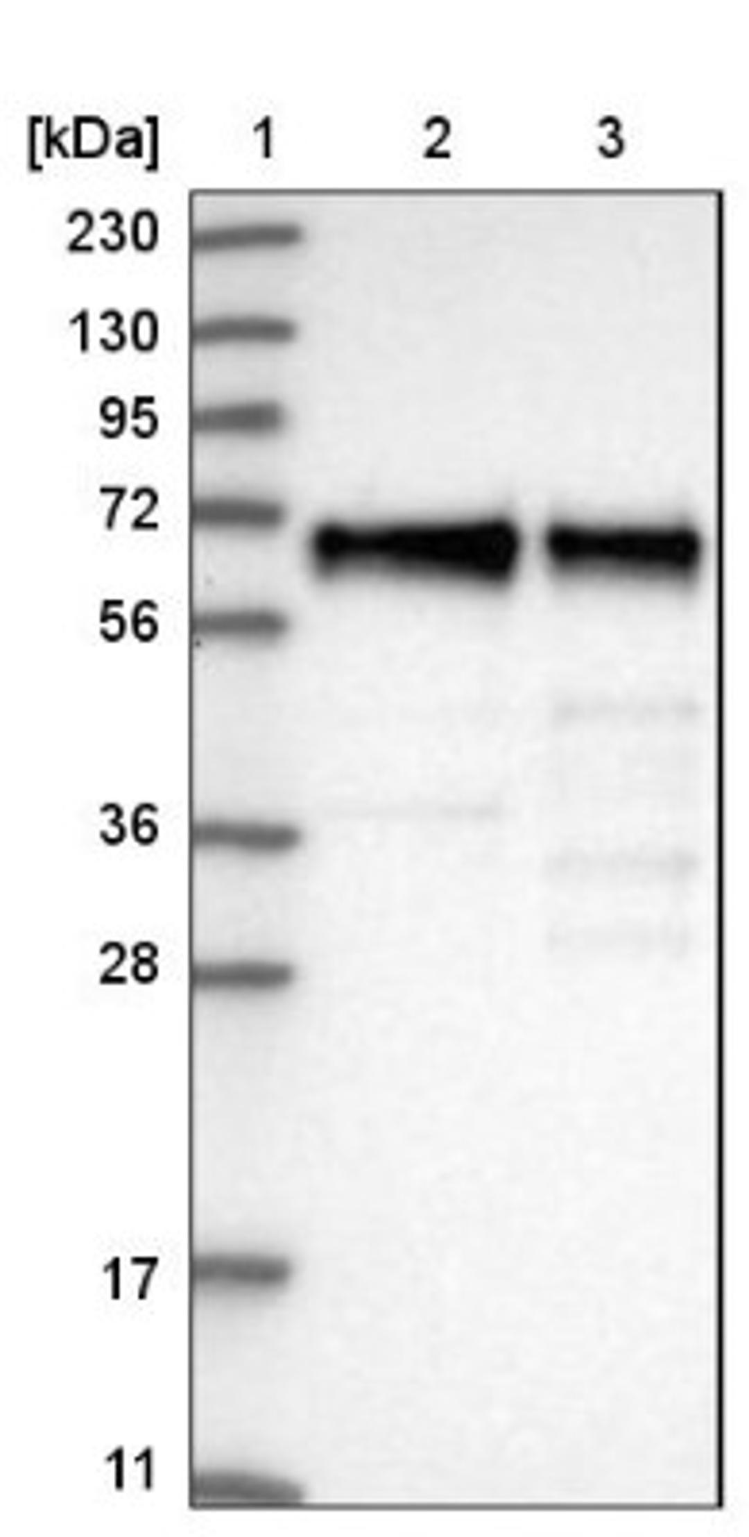 Western Blot: ATF2 Antibody [NBP1-85457] - Lane 1: Marker [kDa] 230, 130, 95, 72, 56, 36, 28, 17, 11<br/>Lane 2: Human cell line RT-4<br/>Lane 3: Human cell line U-251MG sp