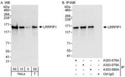 Detection of human LRRFIP1 by western blot and immunoprecipitation.