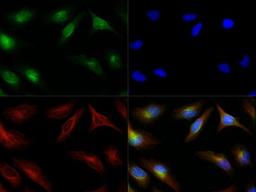 Immunocytochemistry/Immunofluorescence: Endothelial Lipase Antibody [NB400-111] - Antibody was tested in HeLa cells with Dylight 488 (green). Nuclei and alpha-tubulin were counterstained with DAPI (blue) and Dylight 550 (red).