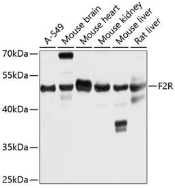 Western blot - F2R antibody (A5641)