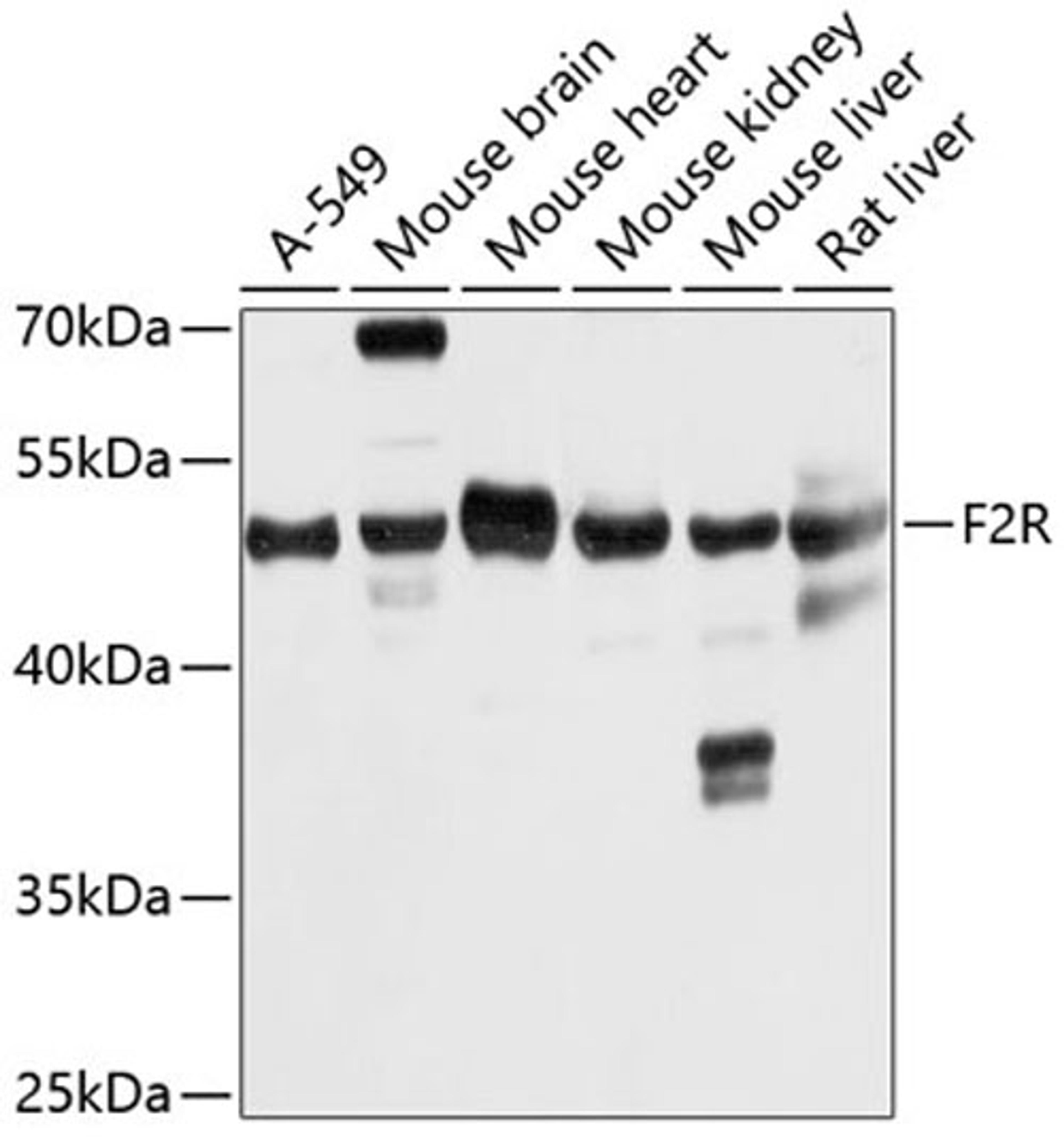 Western blot - F2R antibody (A5641)