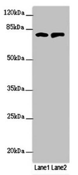 Western blot. All lanes: RUFY2 antibody at 1.69ug/ml. Lane 1: PC-3 whole cell lysate. Lane 2: Mouse spleen tissue. Secondary. Goat polyclonal to rabbit IgG at 1/10000 dilution. Predicted band size: 76, 71, 75, 47, 44 kDa. Observed band size: 76 kDa.