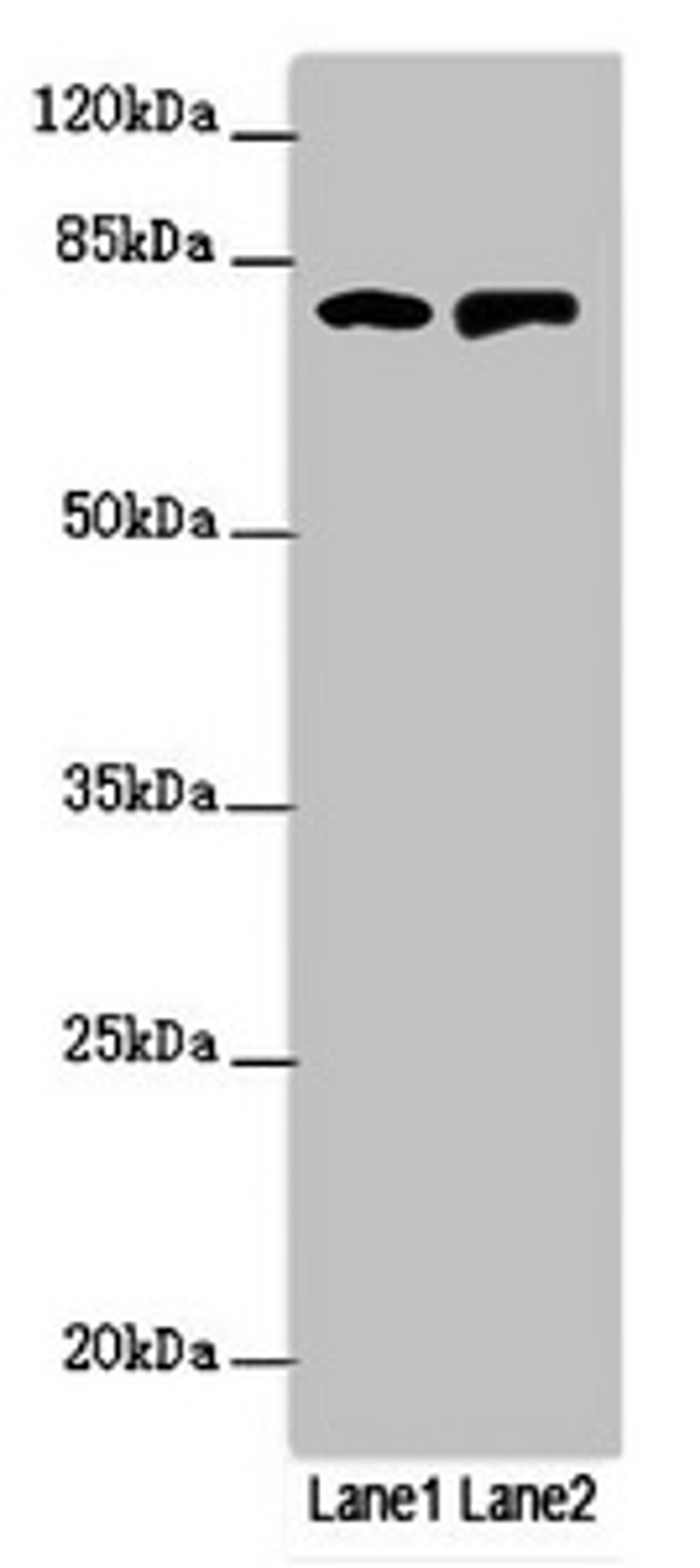 Western blot. All lanes: RUFY2 antibody at 1.69ug/ml. Lane 1: PC-3 whole cell lysate. Lane 2: Mouse spleen tissue. Secondary. Goat polyclonal to rabbit IgG at 1/10000 dilution. Predicted band size: 76, 71, 75, 47, 44 kDa. Observed band size: 76 kDa.
