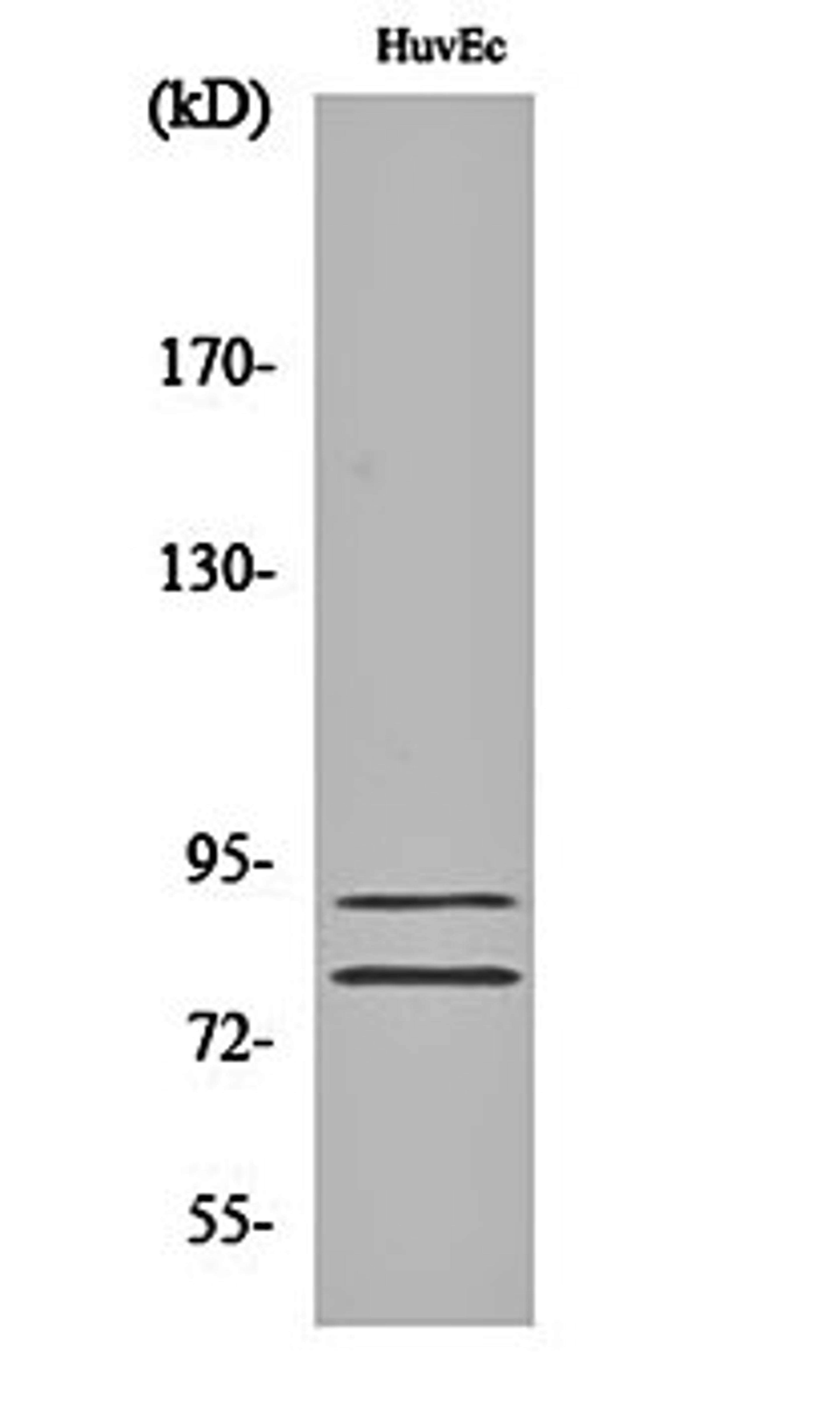 Western blot analysis of HuvEc cell lysates using TGase2 antibody