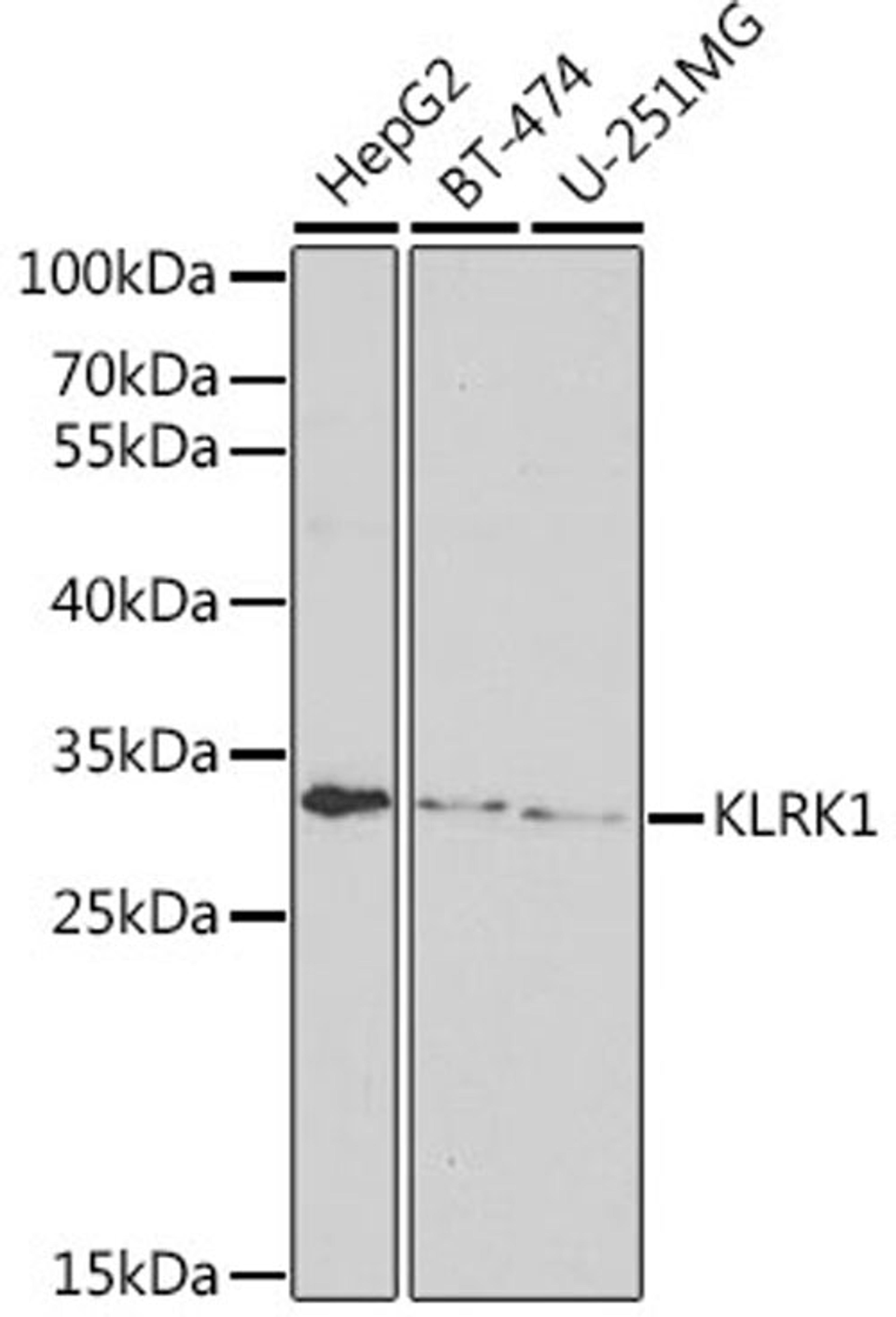 Western blot - KLRK1 antibody (A6123)