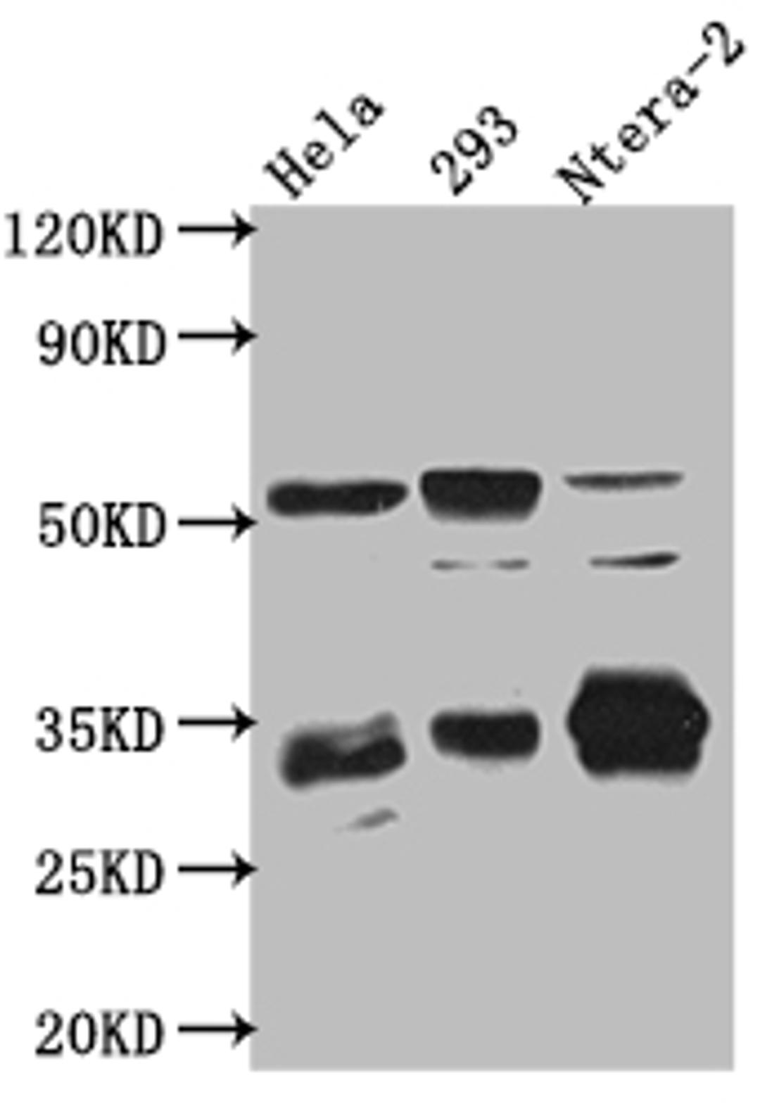 Western Blot. Positive WB detected in: Hela whole cell lysate, HEK293 whole cell lysate, Ntera-2 cell lysate. All lanes: CASP3 antibody at 1:1000. Secondary. Goat polyclonal to rabbit IgG at 1/50000 dilution. Predicted band size: 32 kDa. Observed band size: 32, 55, 130 kDa.