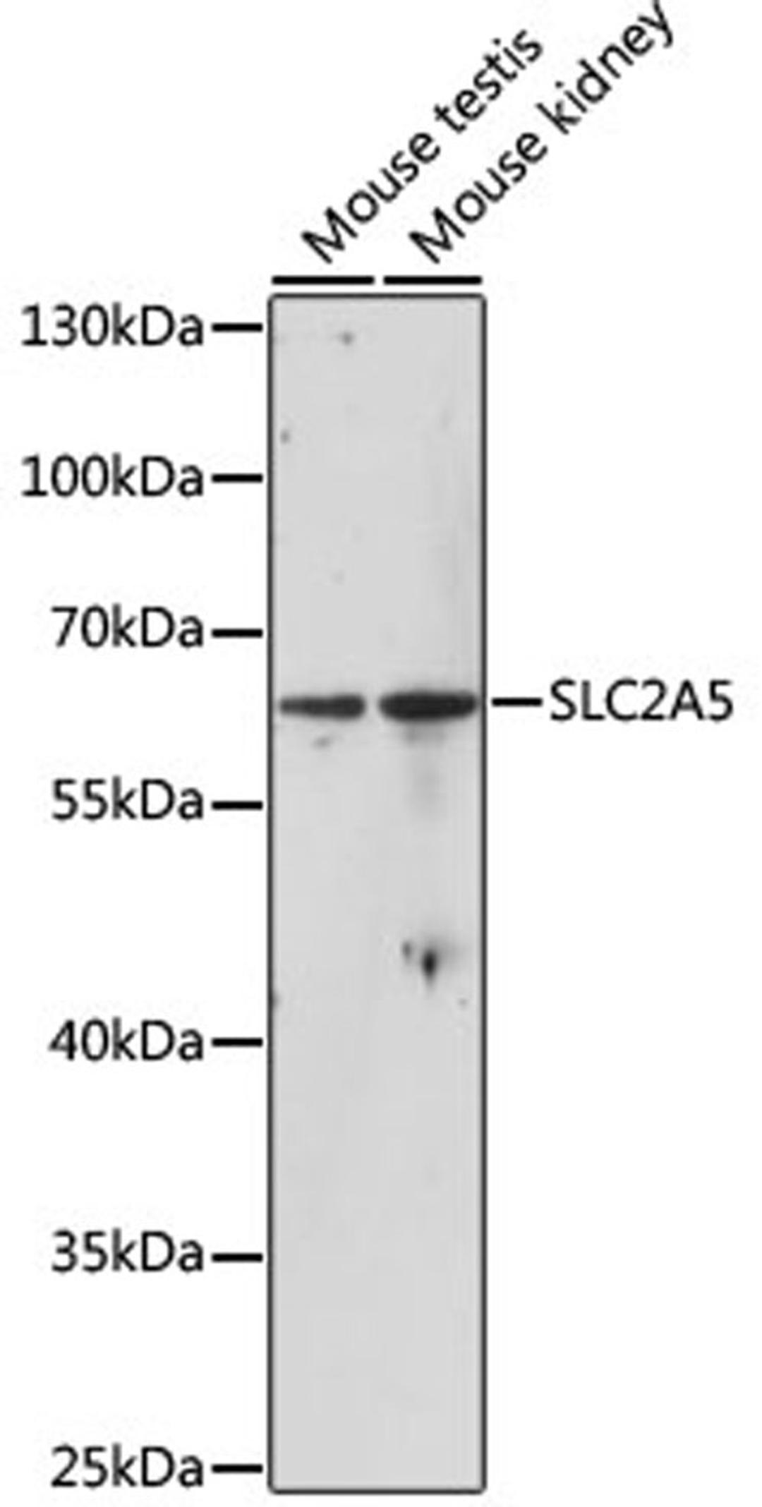 Western blot - SLC2A5 antibody (A13650)