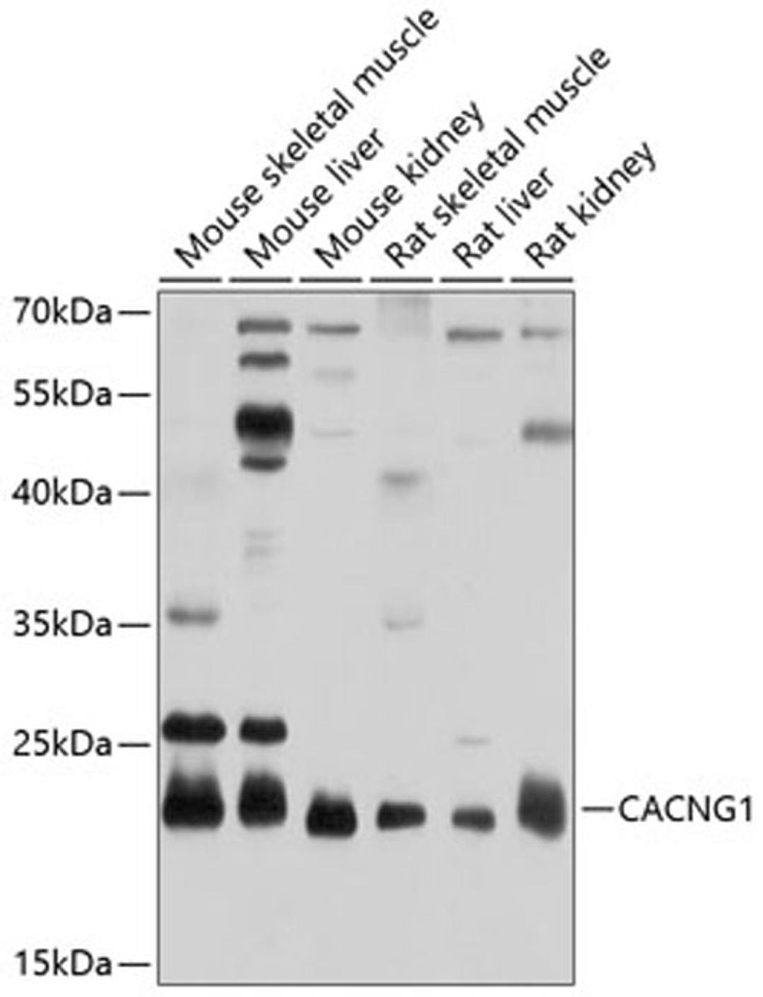 Western blot - CACNG1 antibody (A10014)