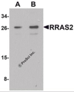 Western blot analysis of RRAS2 in Jurkat cell lysate with RRAS2 antibody at (A) 1 and (B) 2 &#956;g/mL