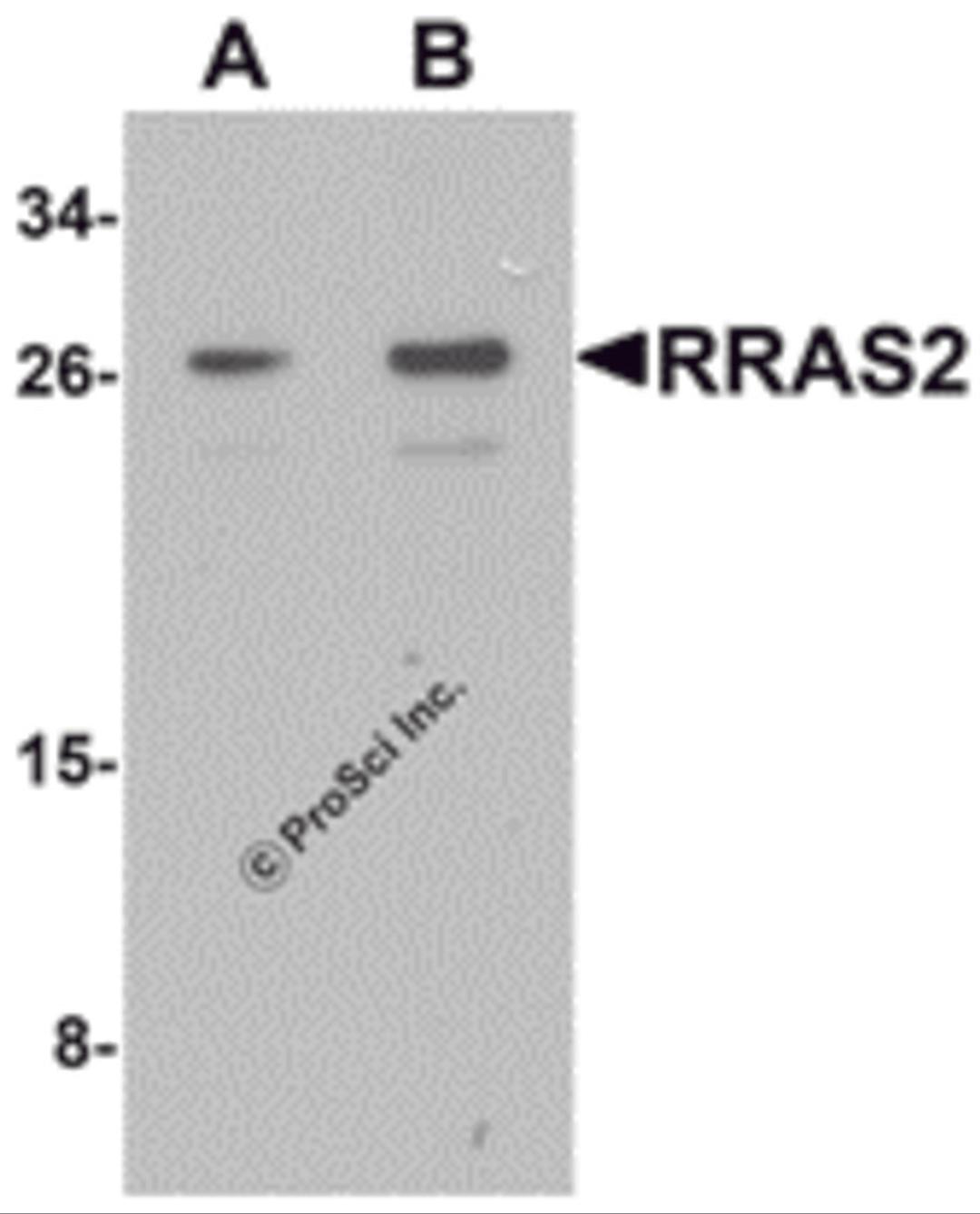 Western blot analysis of RRAS2 in Jurkat cell lysate with RRAS2 antibody at (A) 1 and (B) 2 μg/mL