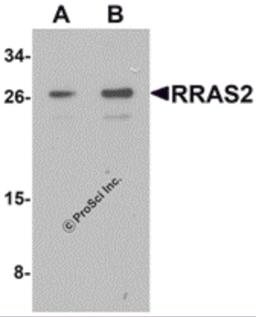 Western blot analysis of RRAS2 in Jurkat cell lysate with RRAS2 antibody at (A) 1 and (B) 2 μg/mL