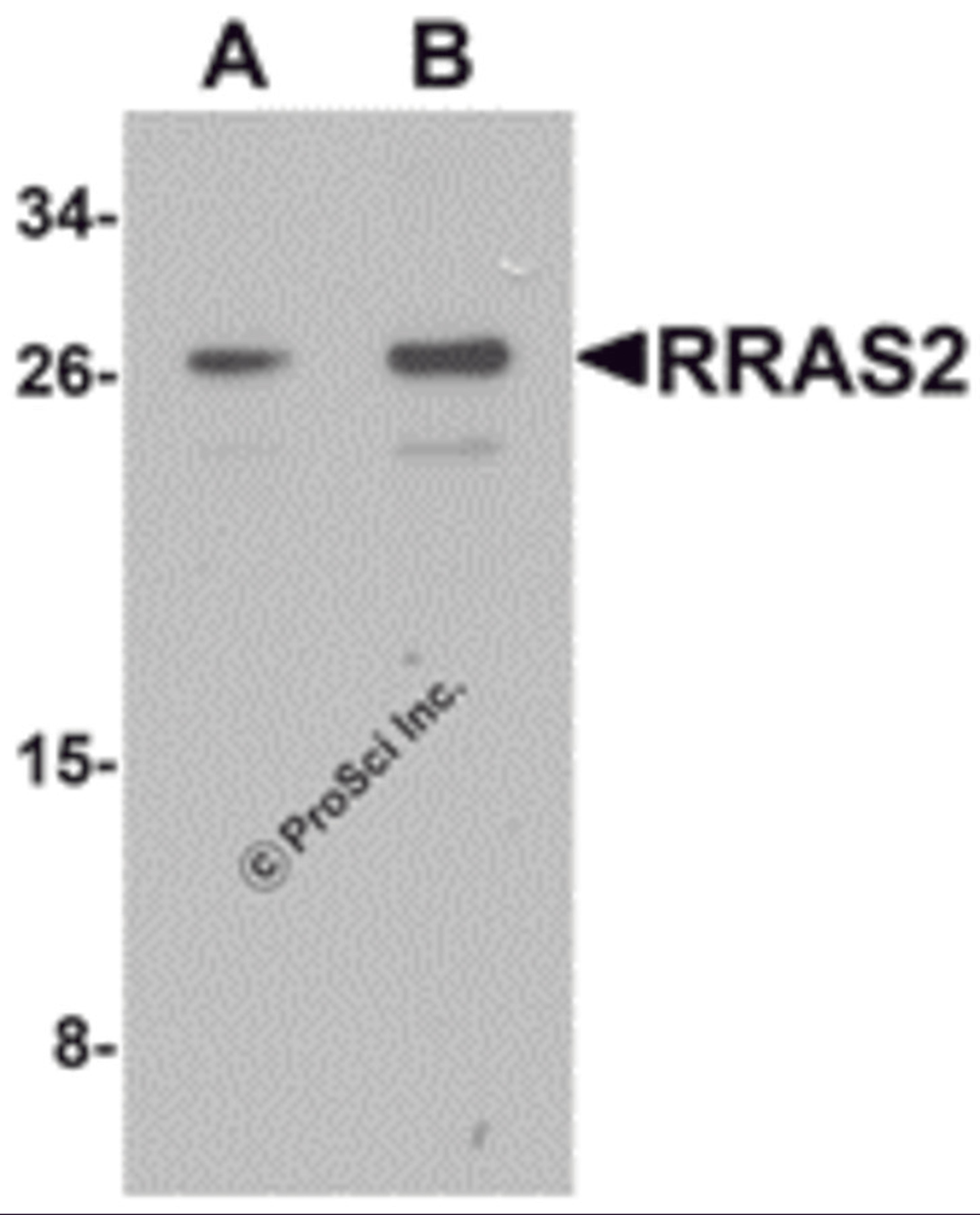 Western blot analysis of RRAS2 in Jurkat cell lysate with RRAS2 antibody at (A) 1 and (B) 2 μg/mL