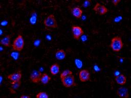 Immunofluorescence image of mouse brain tissue using anti-Collagen II (dilution at 1:300)