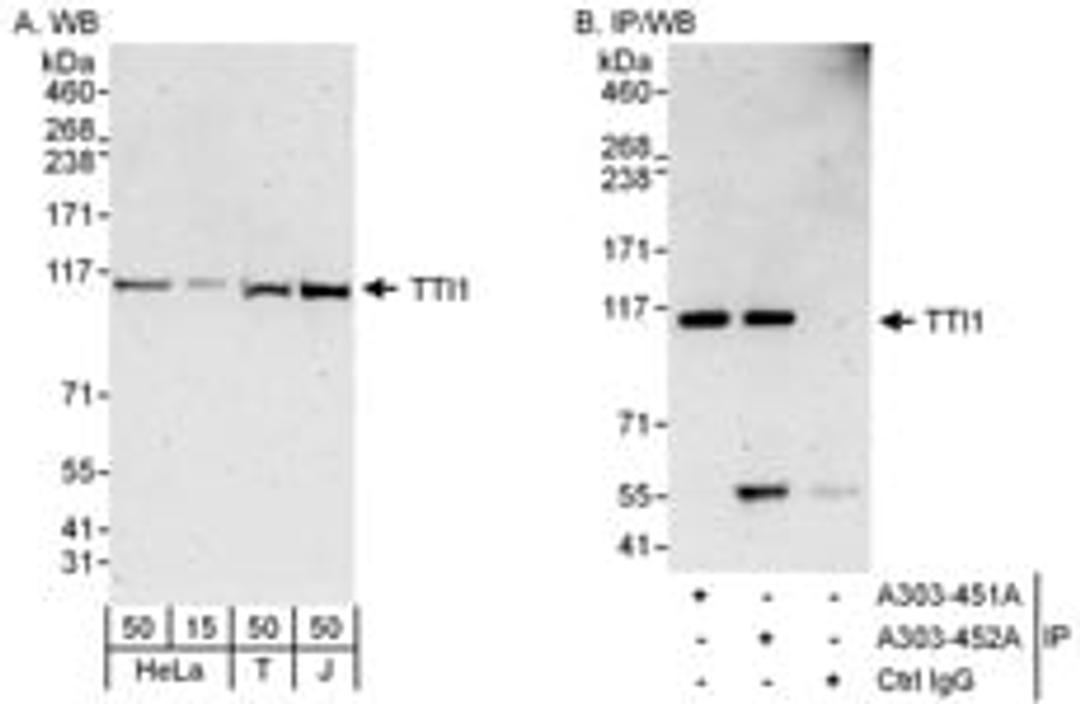 Detection of human TTI1 by western blot and immunoprecipitation.