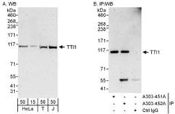 Detection of human TTI1 by western blot and immunoprecipitation.