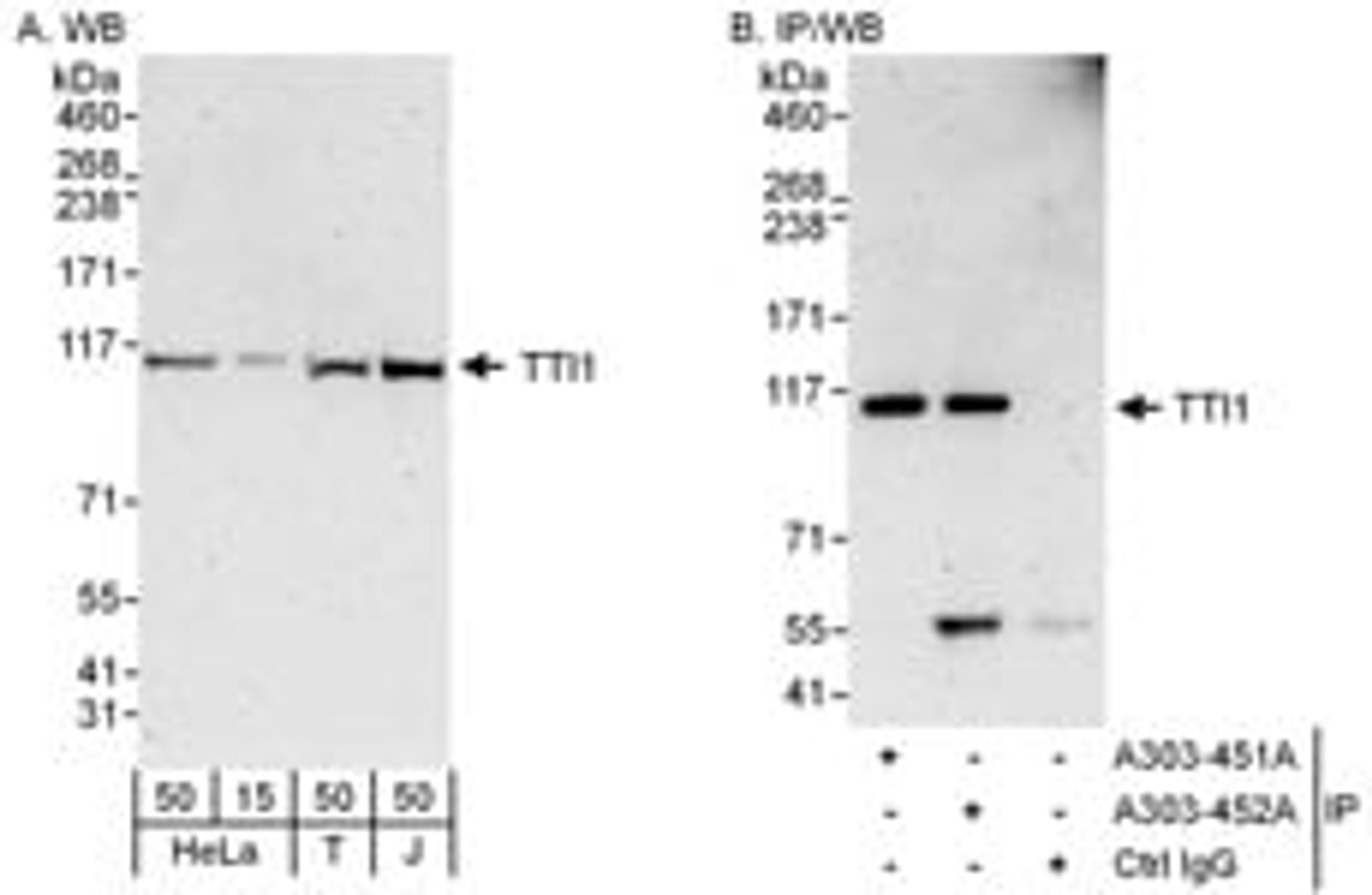 Detection of human TTI1 by western blot and immunoprecipitation.