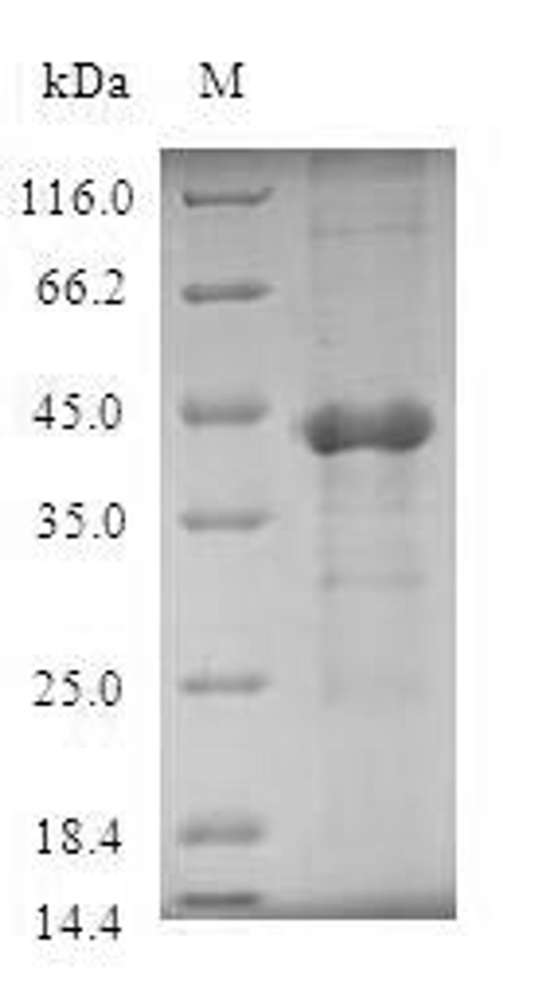 (Tris-Glycine gel) Discontinuous SDS-PAGE (reduced) with 5% enrichment gel and 15% separation gel.