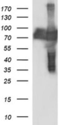 Western Blot: CEP68 Antibody (5B4) [NBP2-46252] - Analysis of HEK293T cells were transfected with the pCMV6-ENTRY control (Left lane) or pCMV6-ENTRY CEP68.