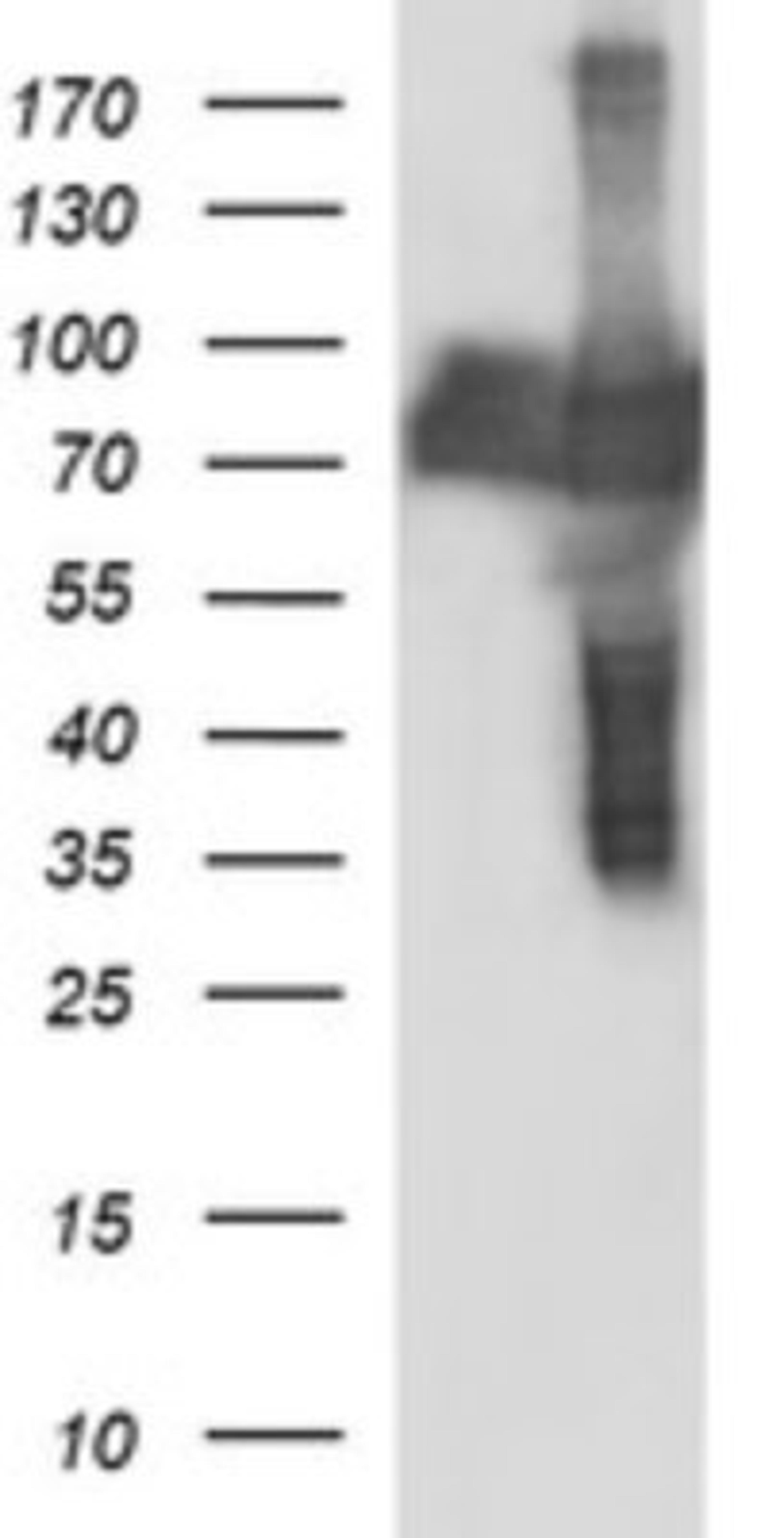 Western Blot: CEP68 Antibody (5B4) [NBP2-46252] - Analysis of HEK293T cells were transfected with the pCMV6-ENTRY control (Left lane) or pCMV6-ENTRY CEP68.