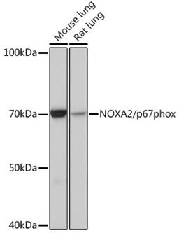 Western blot - NOXA2/p67phox Rabbit mAb (A3703)