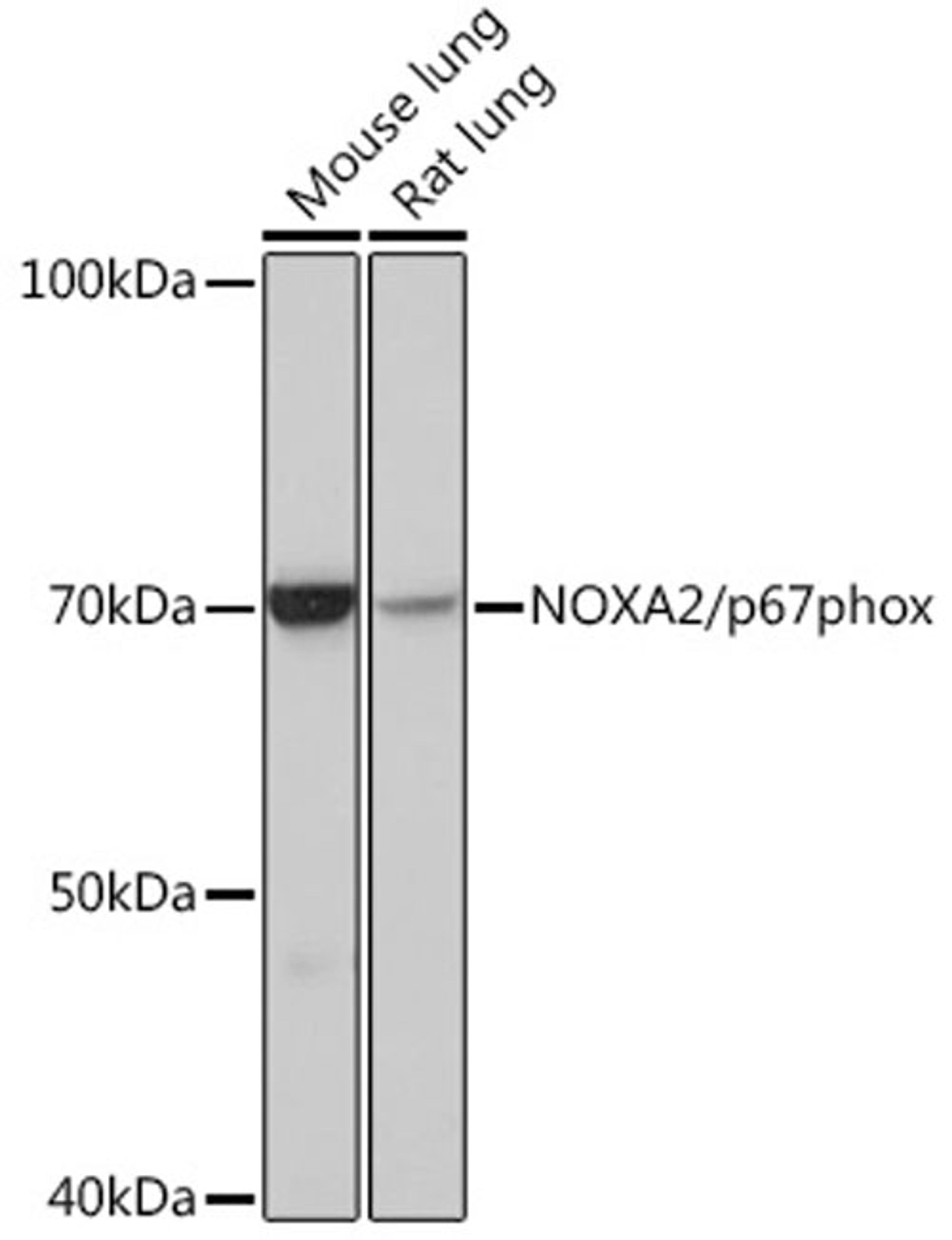 Western blot - NOXA2/p67phox Rabbit mAb (A3703)