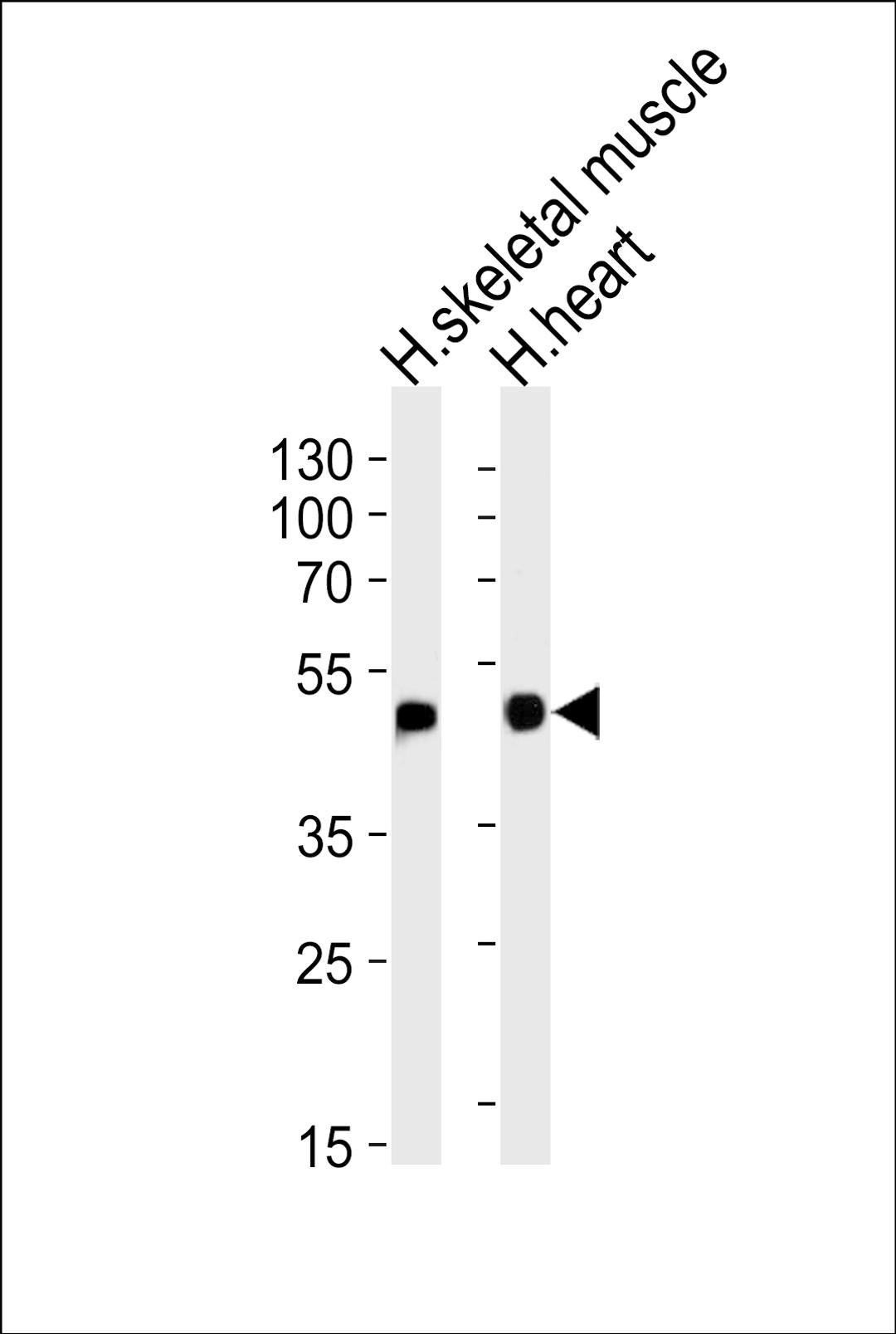 Western blot analysis of lysates from human skeletal muscle and heart tissue lysates (from left to right), using HFE2 Antibody at 1:1000 at each lane.