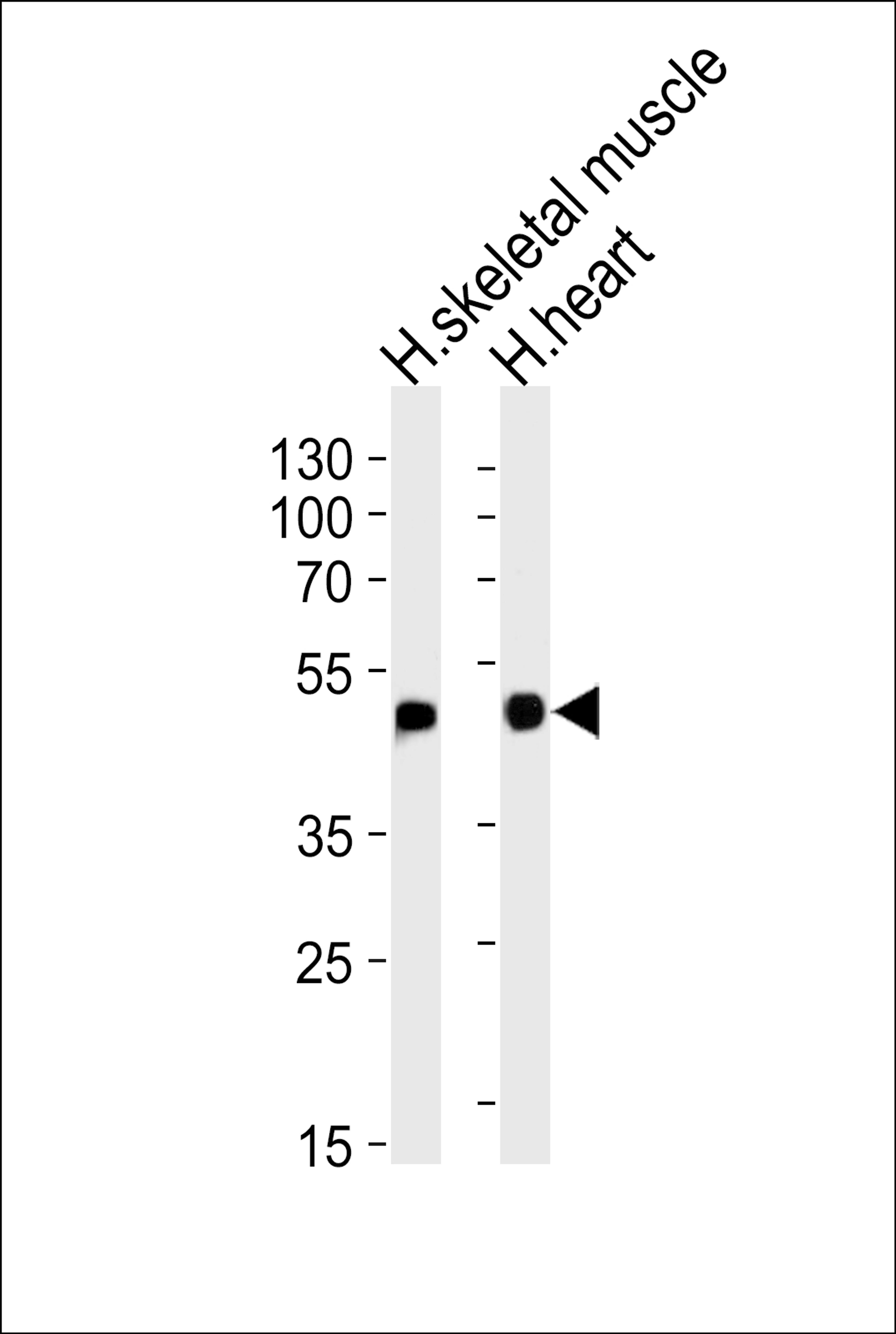 Western blot analysis of lysates from human skeletal muscle and heart tissue lysates (from left to right), using HFE2 Antibody at 1:1000 at each lane.