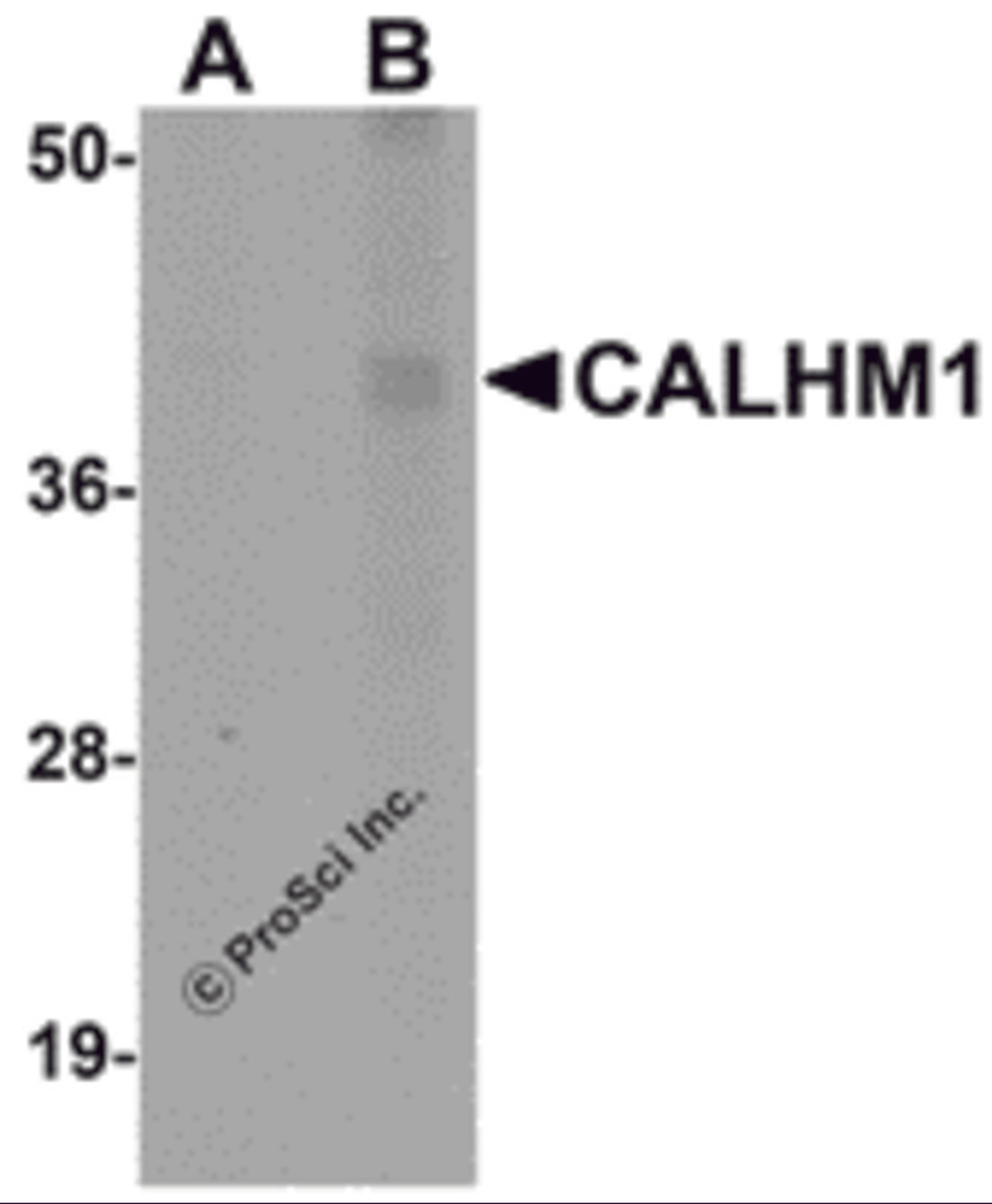 Western blot analysis of CALHM1 in rat liver tissue lysate with CALHM1 antibody at (A) 1 and (B) 2 &#956;g/mL.