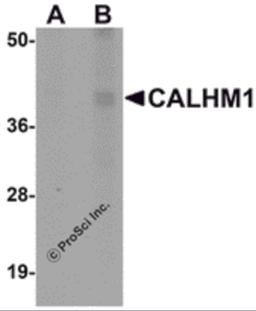 Western blot analysis of CALHM1 in rat liver tissue lysate with CALHM1 antibody at (A) 1 and (B) 2 μg/mL.
