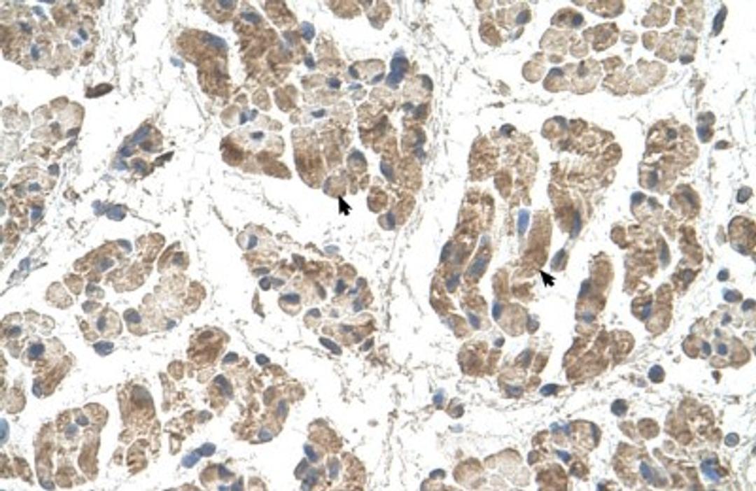 Immunohistochemistry: SSR2 Antibody [NBP1-69471] - Staining of human Muscle.