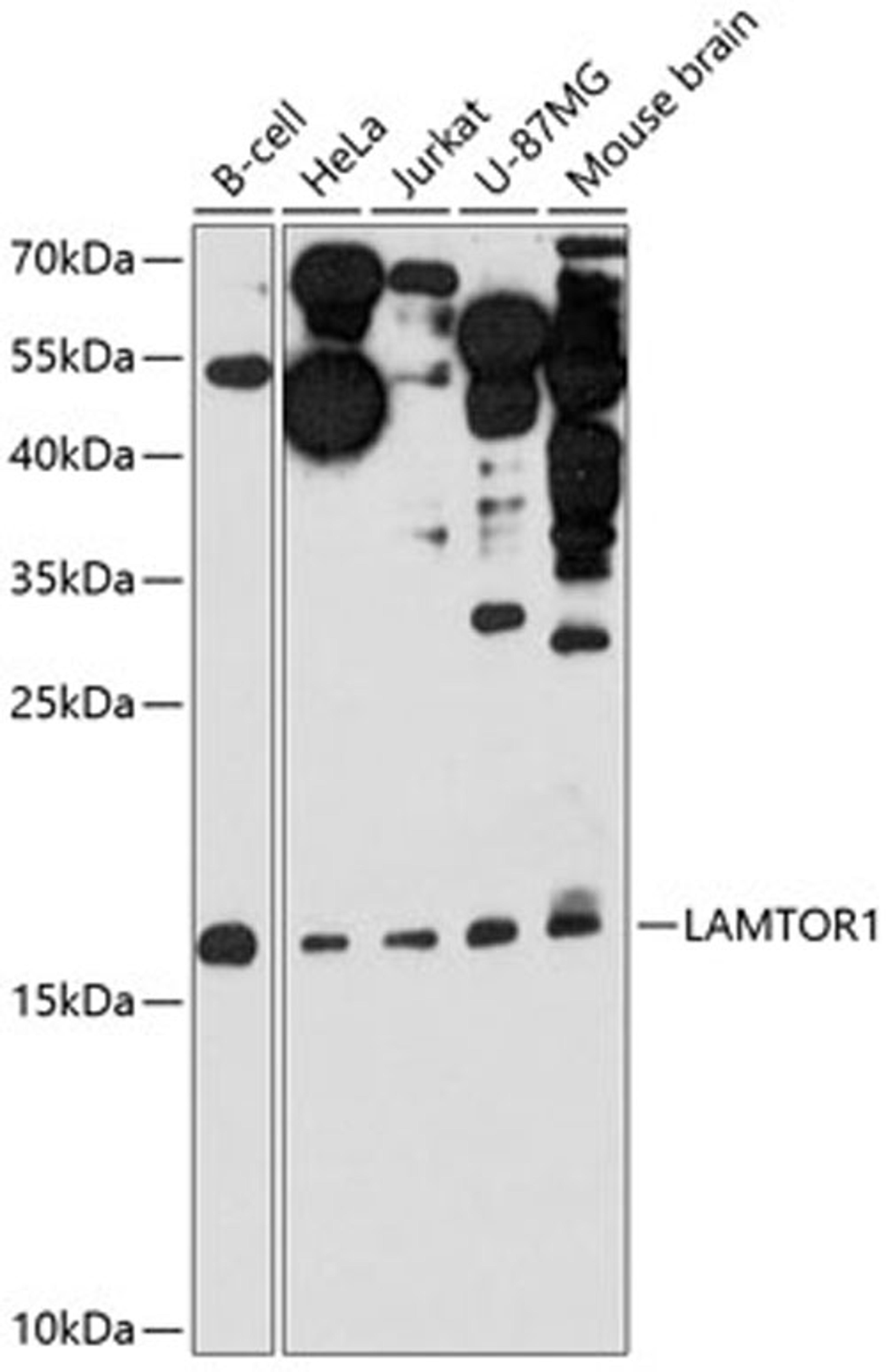 Western blot - LAMTOR1 antibody (A11619)