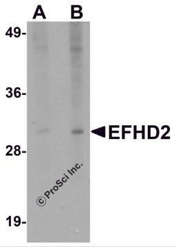 Western blot analysis of EFHD2 in mouse brain tissue lysate with EFHD2 antibody at (A) 1 and (B) 2 &#956;g/mL.