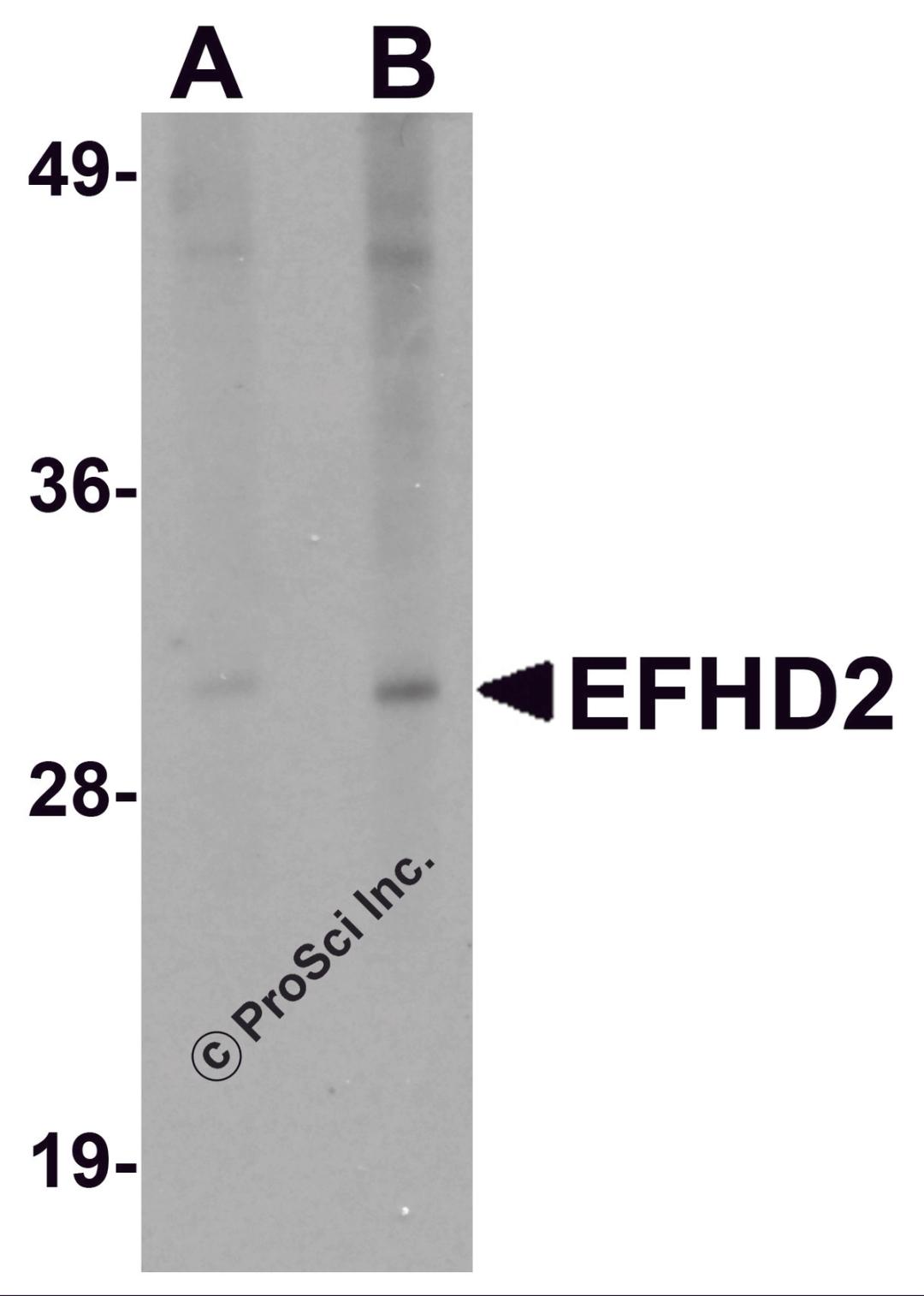 Western blot analysis of EFHD2 in mouse brain tissue lysate with EFHD2 antibody at (A) 1 and (B) 2 μg/mL.