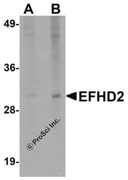 Western blot analysis of EFHD2 in mouse brain tissue lysate with EFHD2 antibody at (A) 1 and (B) 2 μg/mL.