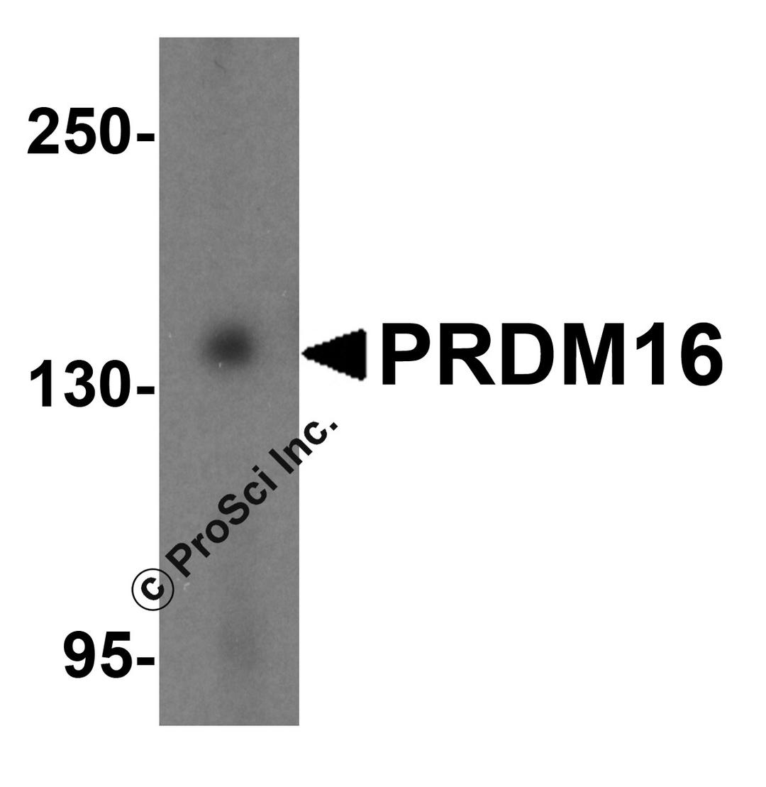 Western blot analysis of PRDM16 in K562 cell lysate with PRDM16 antibody at 1 μg/mL.