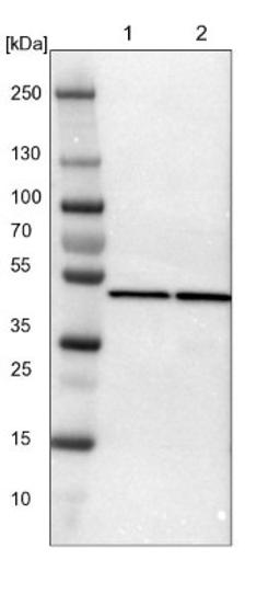 Western Blot: Proteasome 19S S7 Antibody [NBP1-87797] - Lane 1: NIH-3T3 cell lysate (Mouse embryonic fibroblast cells)<br/>Lane 2: NBT-II cell lysate (Rat Wistar bladder tumour cells)