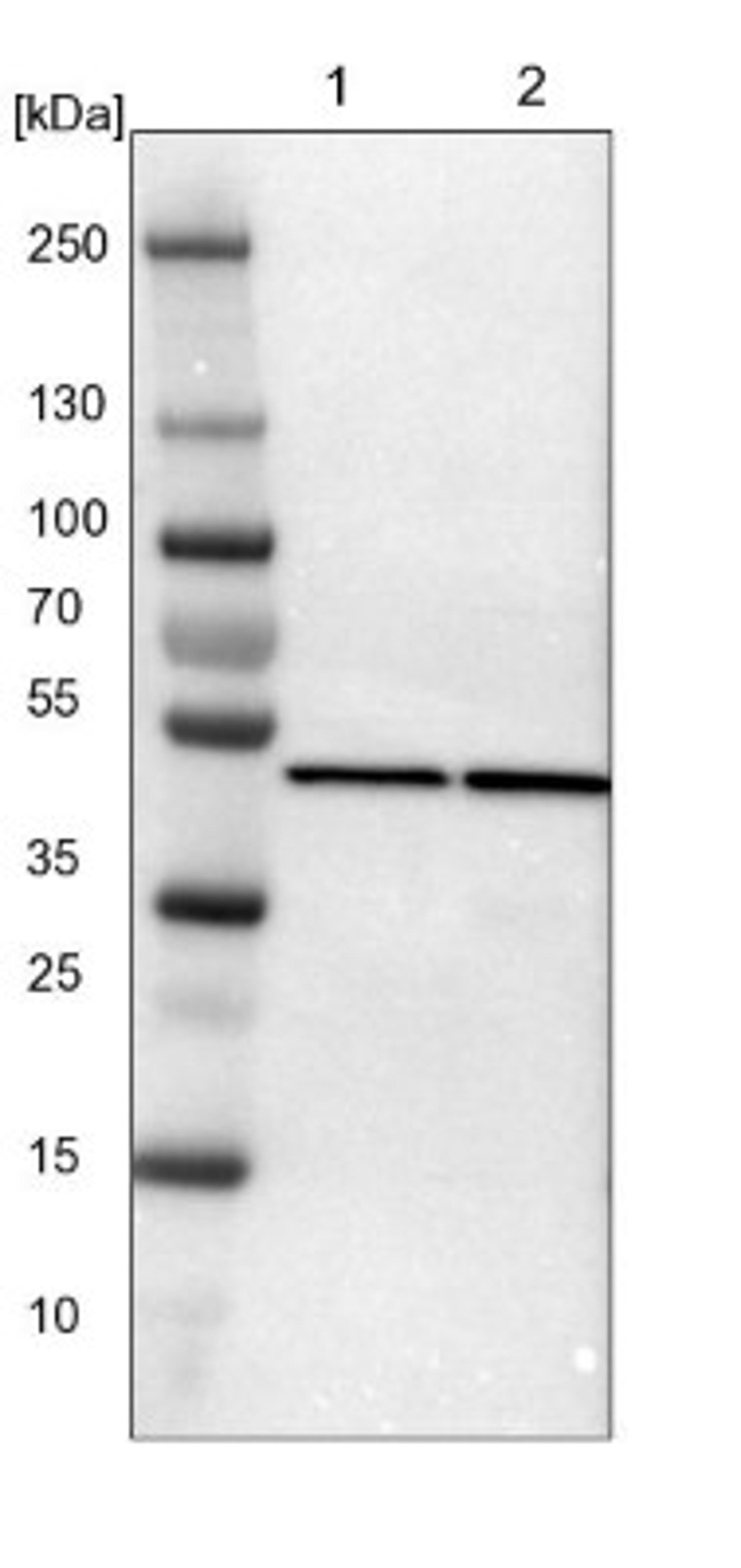 Western Blot: Proteasome 19S S7 Antibody [NBP1-87797] - Lane 1: NIH-3T3 cell lysate (Mouse embryonic fibroblast cells)<br/>Lane 2: NBT-II cell lysate (Rat Wistar bladder tumour cells)