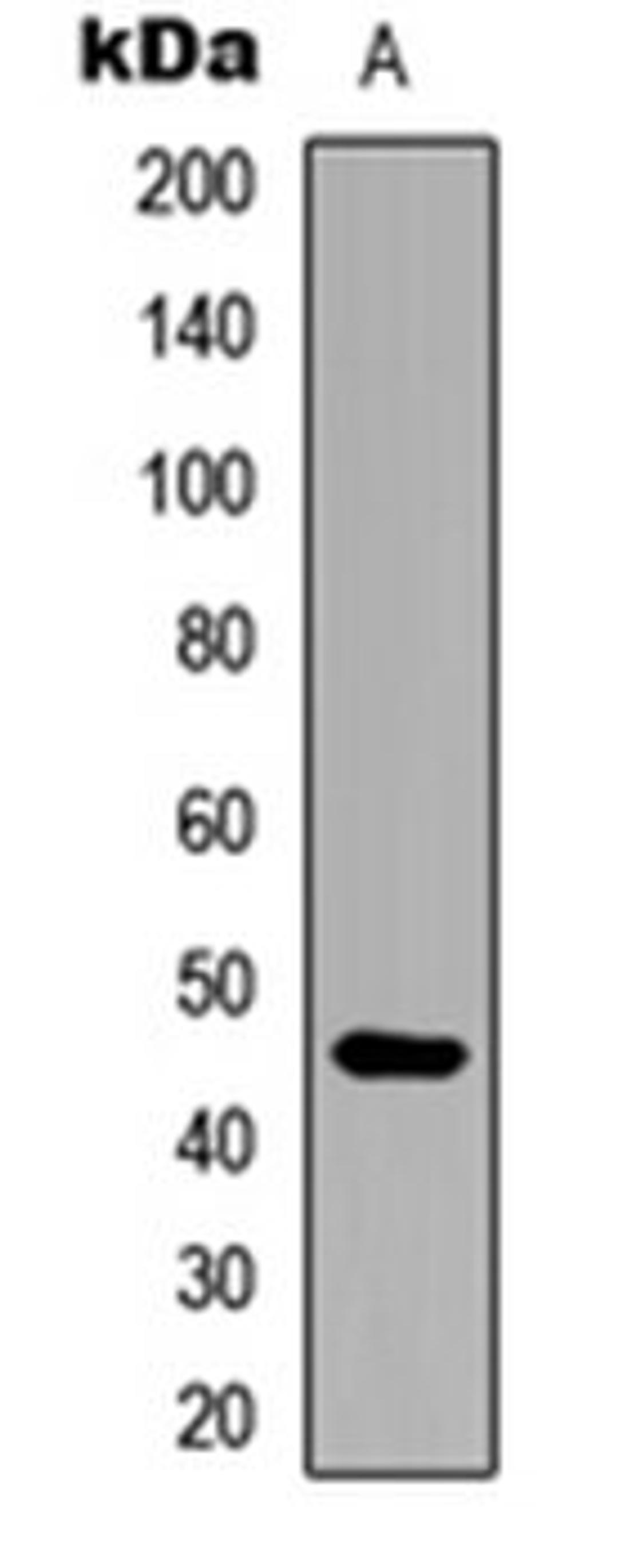 Western blot analysis of human liver (Lane 1) whole cell lysates using ARRDC4 antibody