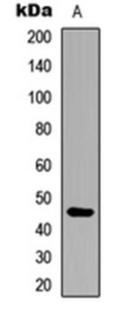 Western blot analysis of human liver (Lane 1) whole cell lysates using ARRDC4 antibody